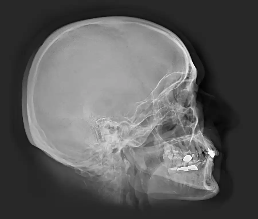 X-ray picture of a human skull made with dicomPacs