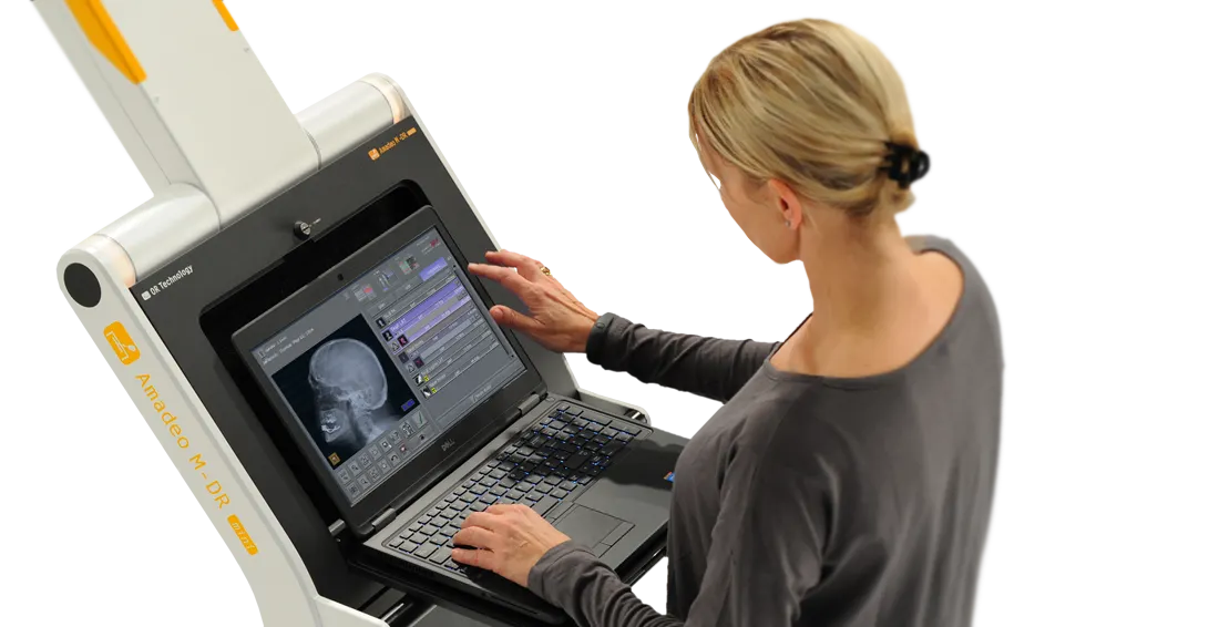 Portable X-ray machines for mobile X-ray services by OR-Technology