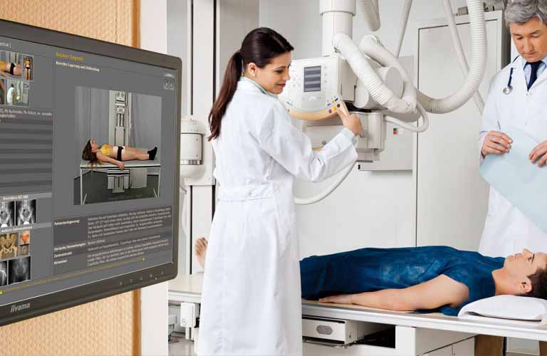Máquina de rayos X digital - Imágenes de rayos X digitales de alta resolución y reducción de la exposición a la radiación