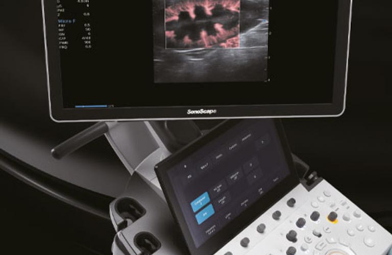 OR sono professional V70 Ultrasound system