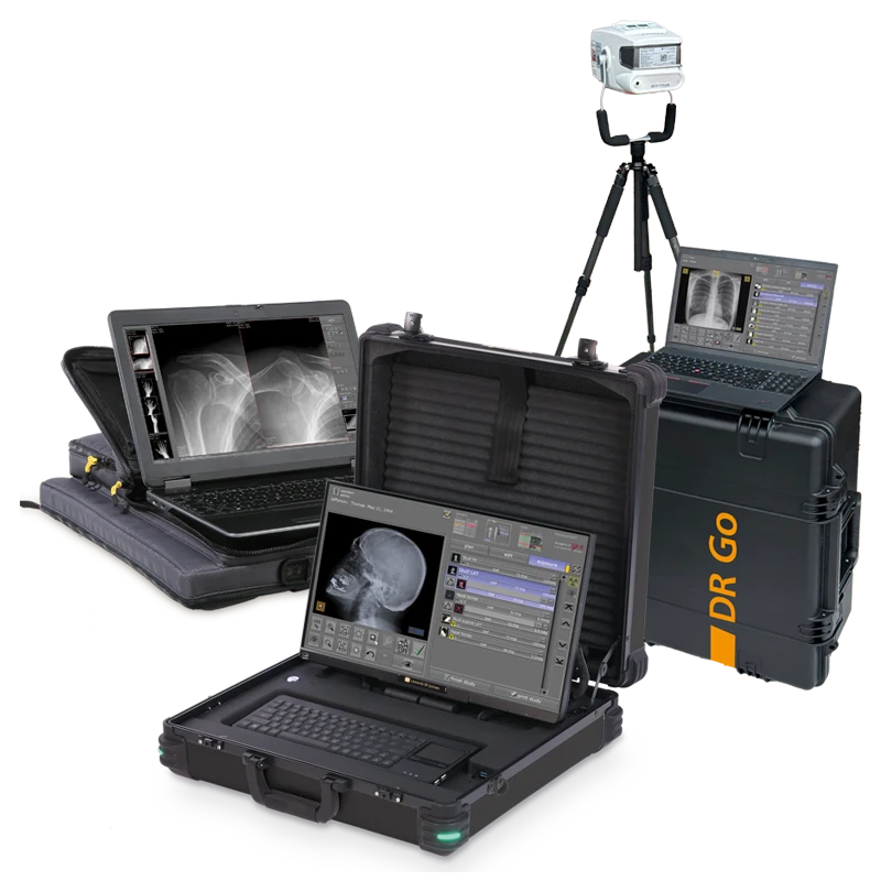 Portable Leonardo DR X-ray systems for human medicine