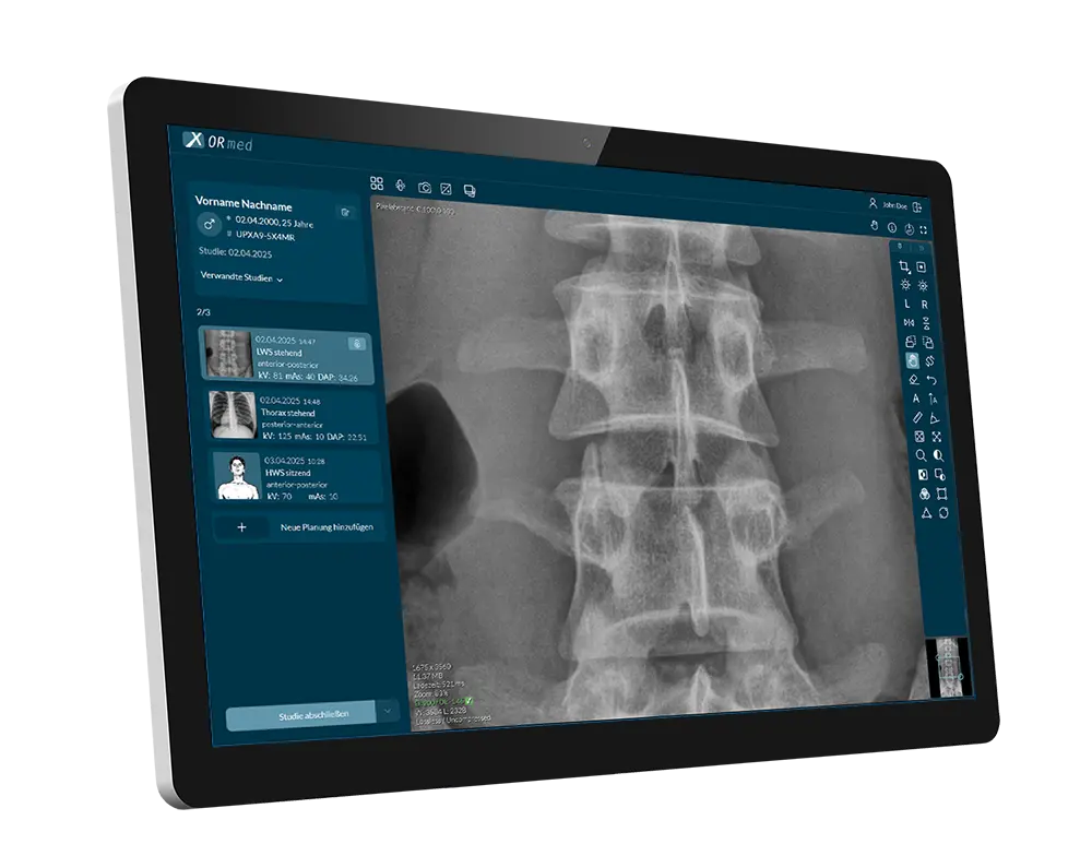 screenshot of the ORmed acquisition software