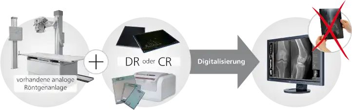 digitales Röntgen